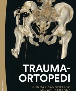 Traumaortopedi